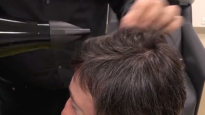 hair restoration for men