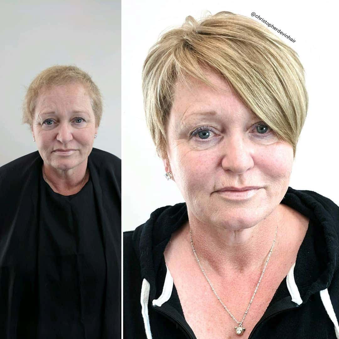 women's hair restoration before and after